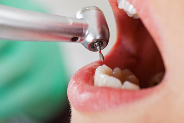 Best Emergency Treatment for Oral Infections in Baxter, MN